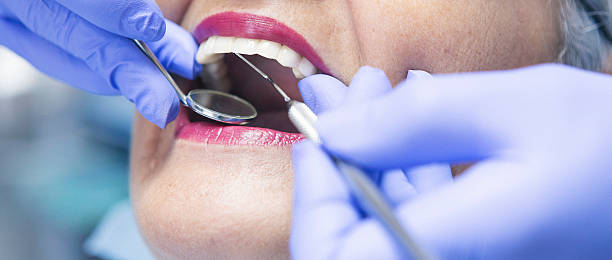Trusted TX Emergency Dentist Experts
